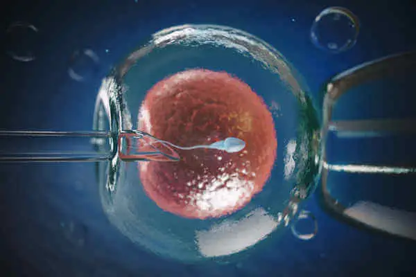 In-vitro fertilization