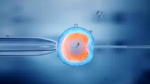 IVF