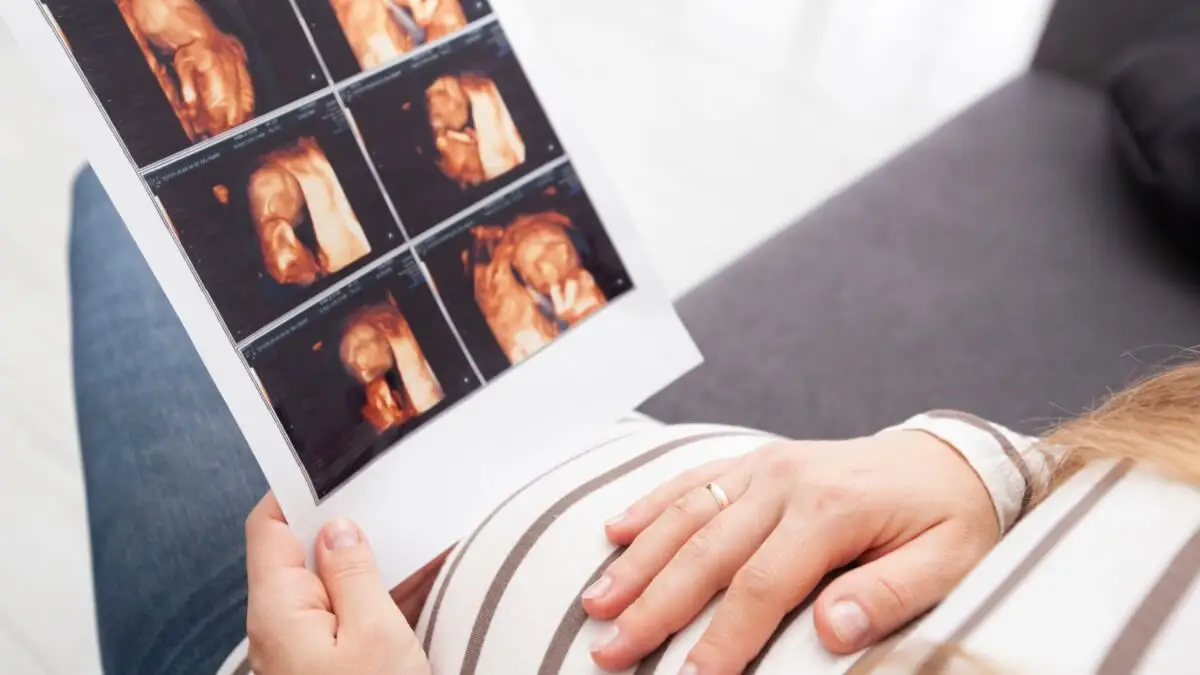 Sonogram